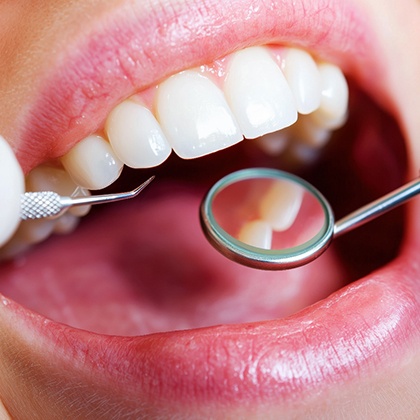 Treating gum disease is an important way to protect your oral health