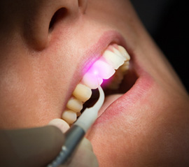 a dentist using a dental laser to treat gum disease